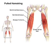 recovery time for grade 2 hamstring tear